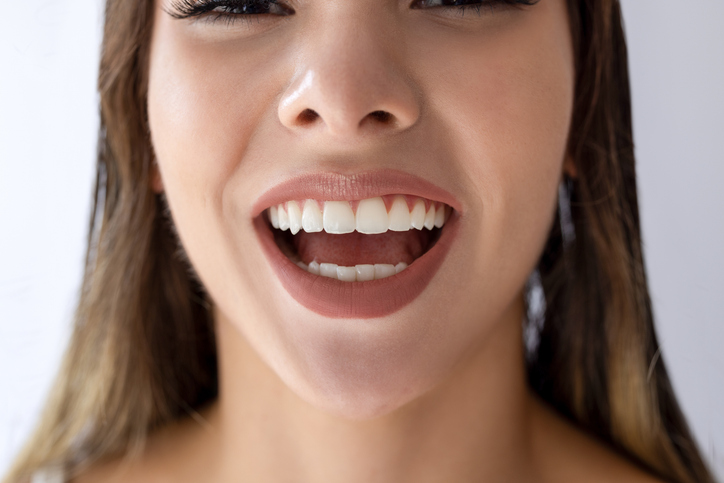 Gummy Smile Correction: How Crown Lengthening Can Enhance Your Smile