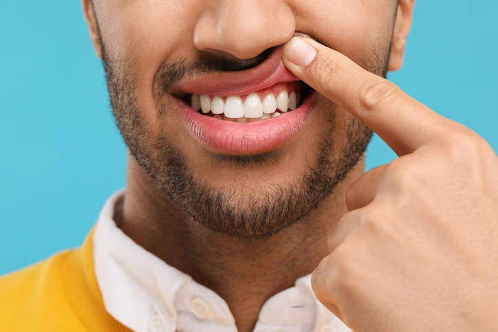 Man showing his healthy teeth and gums